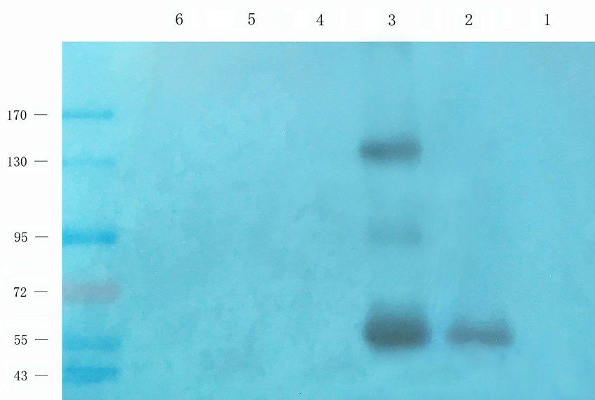 TEK Rabbit Polyclonal Antibody