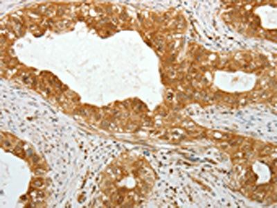 TEKT1 Antibody