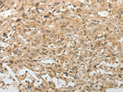 TEKT1 Antibody
