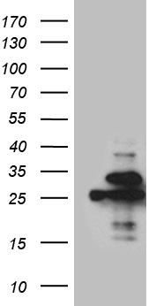 TEKT2 Antibody