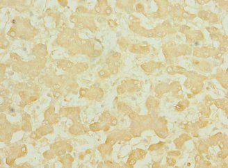 TEKT3 Antibody
