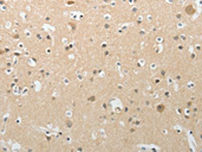 TEKT3 Antibody