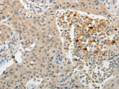 TEKT5 Antibody