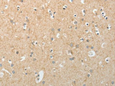 TEKT5 Antibody