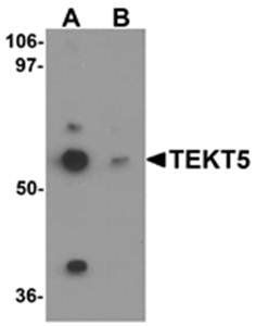 TEKT5 Antibody