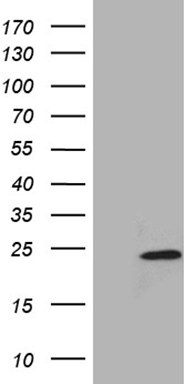 Telethonin (TCAP) antibody