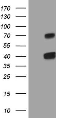 Telethonin Antibody