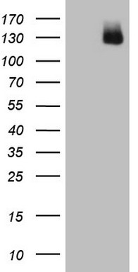 Telethonin Antibody