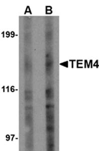 TEM4 Antibody