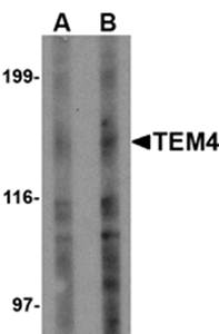 TEM4 Antibody