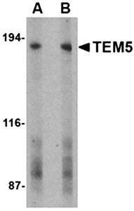 TEM5 Antibody