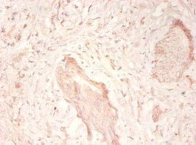 TNC Antibody