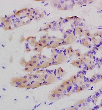 Tenascin C Rabbit Polyclonal Antibody