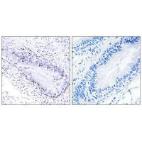 TEP1 Antibody