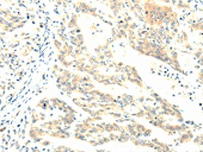 TERF1 Antibody