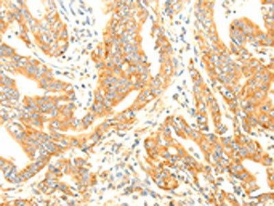 TERF1 Antibody