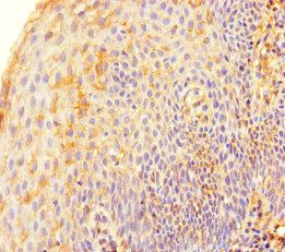 TERF2 Antibody