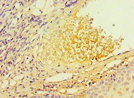 TERF2IP Antibody