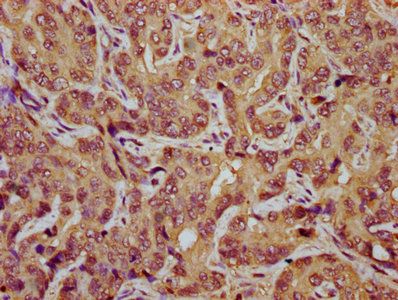 TES Antibody