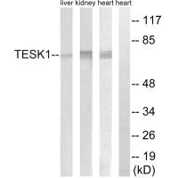 TESK1 antibody