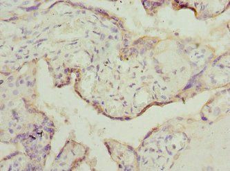 TESK2 Antibody