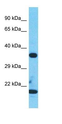 TESPA1 antibody