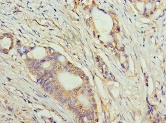 TET1 Antibody