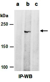 TET1 antibody pair