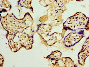 TET2 antibody