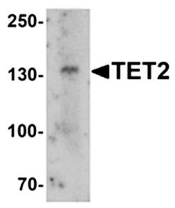 TET2 Antibody