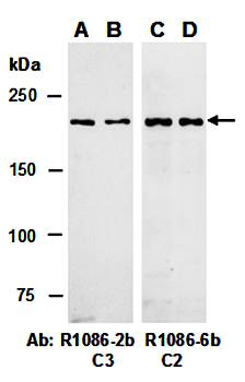 TET2 antibody pair