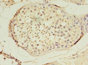 TET3 Antibody