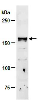 TET3 (C1) Antibody, Rabbit Polyclonal