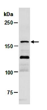TET3 (C1) Antibody, Rabbit Polyclonal