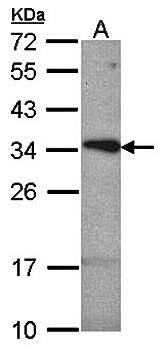 tetraspan 1 antibody