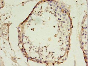 TFAM Antibody