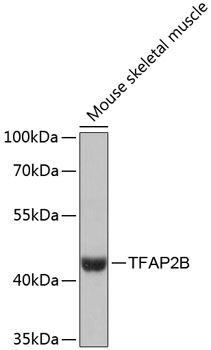 TFAP2B antibody