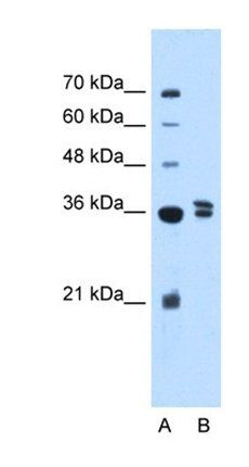 TFB1M antibody