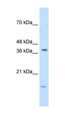TFB2M antibody