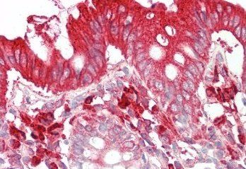 Goat anti-TFB2M Antibody