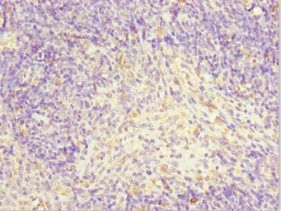 TFCP2 Antibody