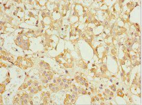 TFCP2 Antibody