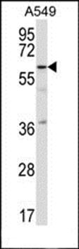 TFCP2L1 antibody