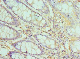 TFDP1 Antibody