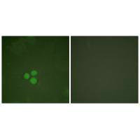 TFDP1 Antibody