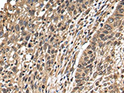 TFDP2 Antibody
