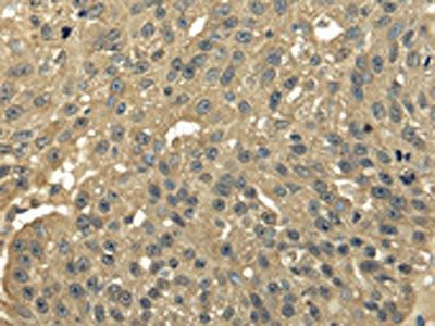 TFDP2 Antibody