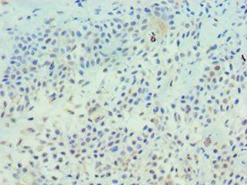 TFF1 antibody