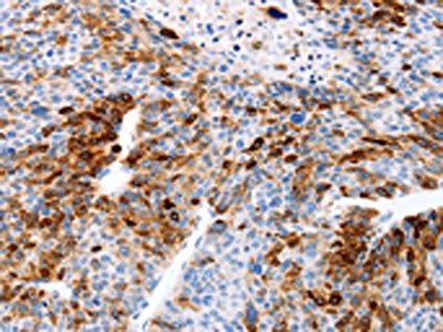 TFF1 antibody