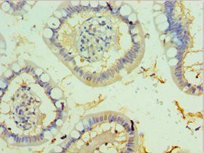 TFF2 antibody